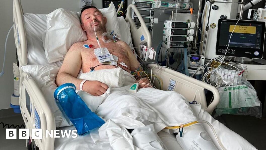 SEPE - Bowel cancer patient issues warning about silent killer