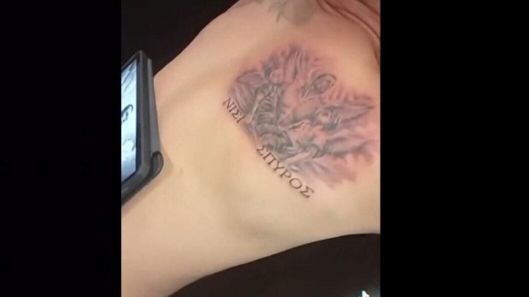 22591362